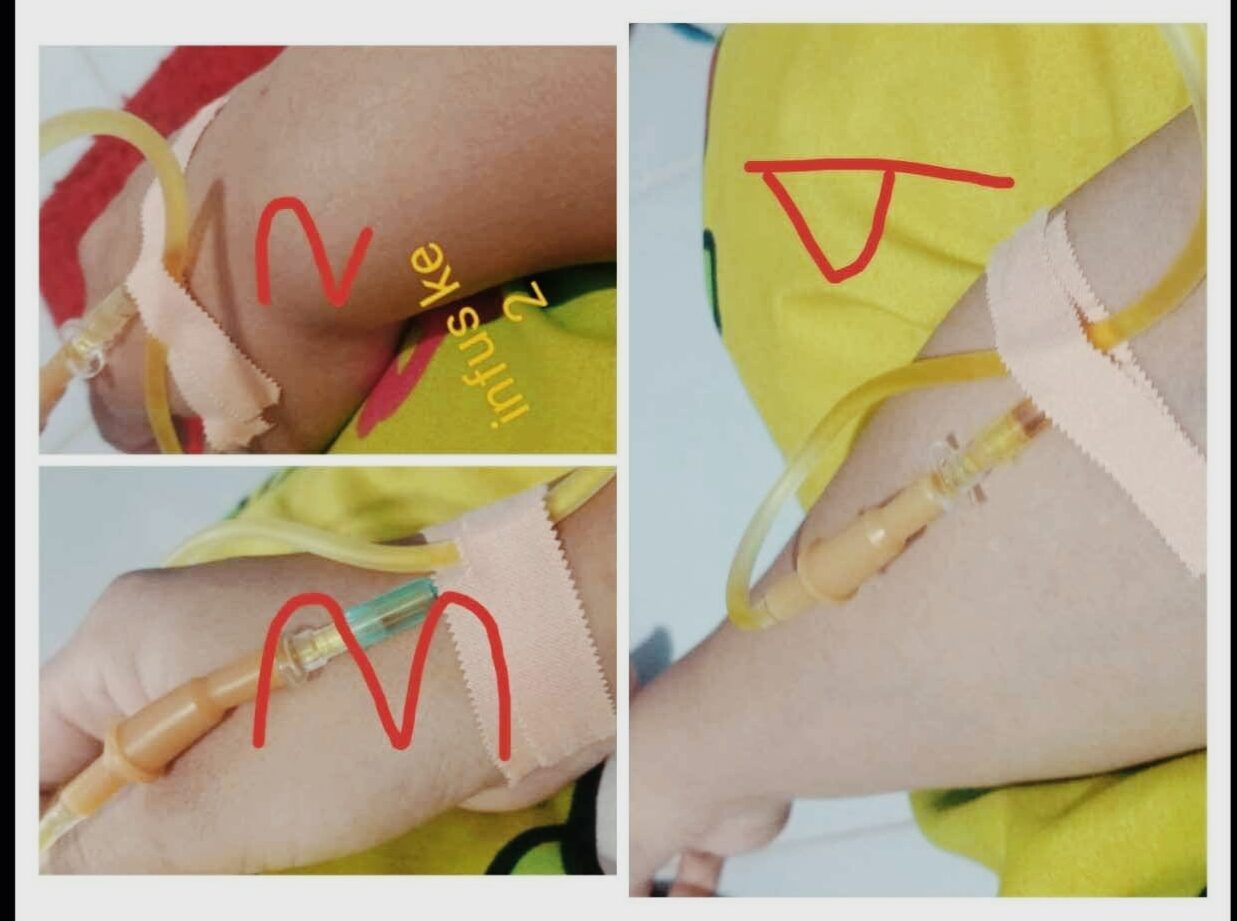 Ingin kulit Putih dan mulus, Amel Tawarkan produk perawatan kulit untuk anda salah satunya Infus Whitening